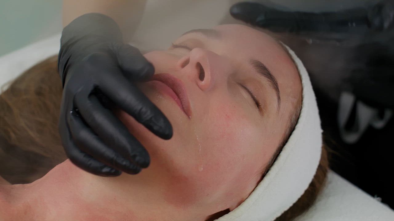 Augenbrauenlift mit Botox — Nachher
